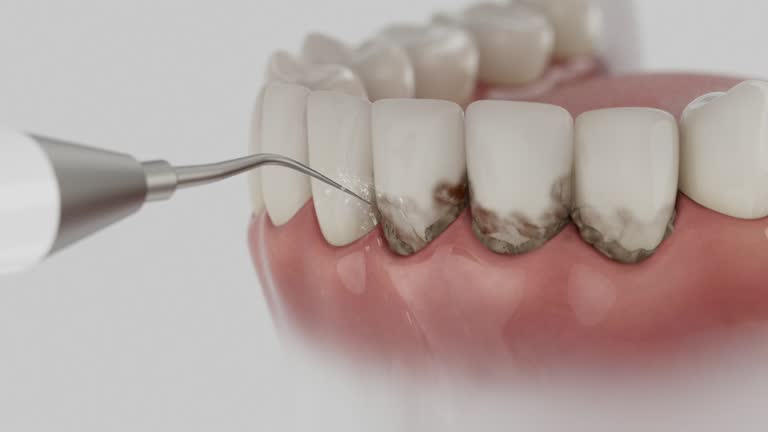 Trusted Teeth Cleaning And Checkup service in Oglethorpe, GA - Dentist Open Now